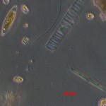 Eine Elektronenmikroskopaufnahme von Eisalgen